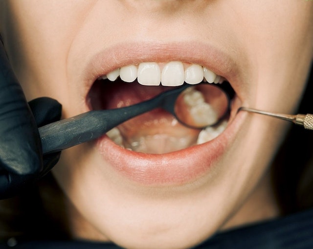 How Oral Health Affects Your Overall Health 