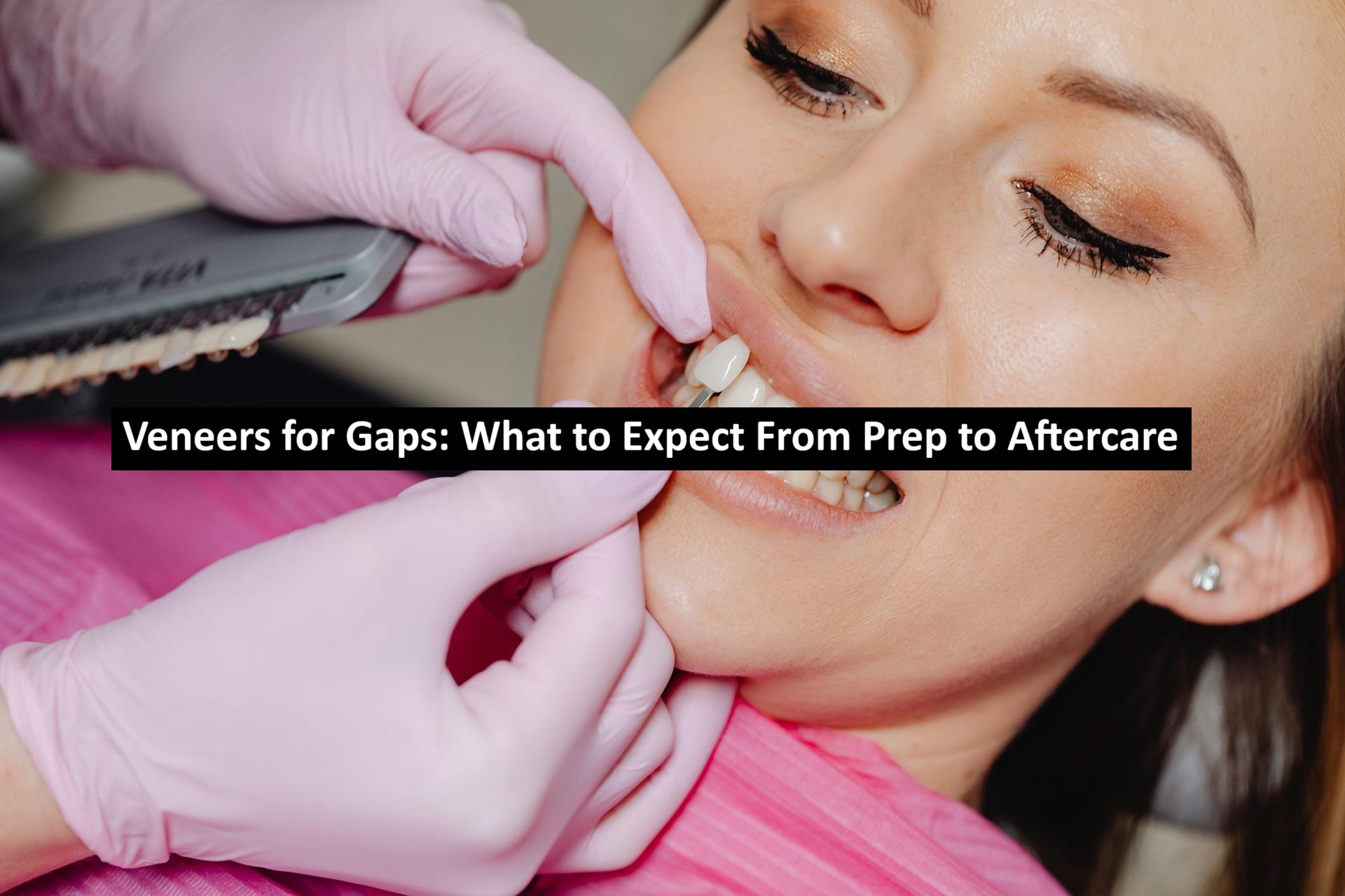 Veneers for Gaps: What to Expect From Prep to Aftercare