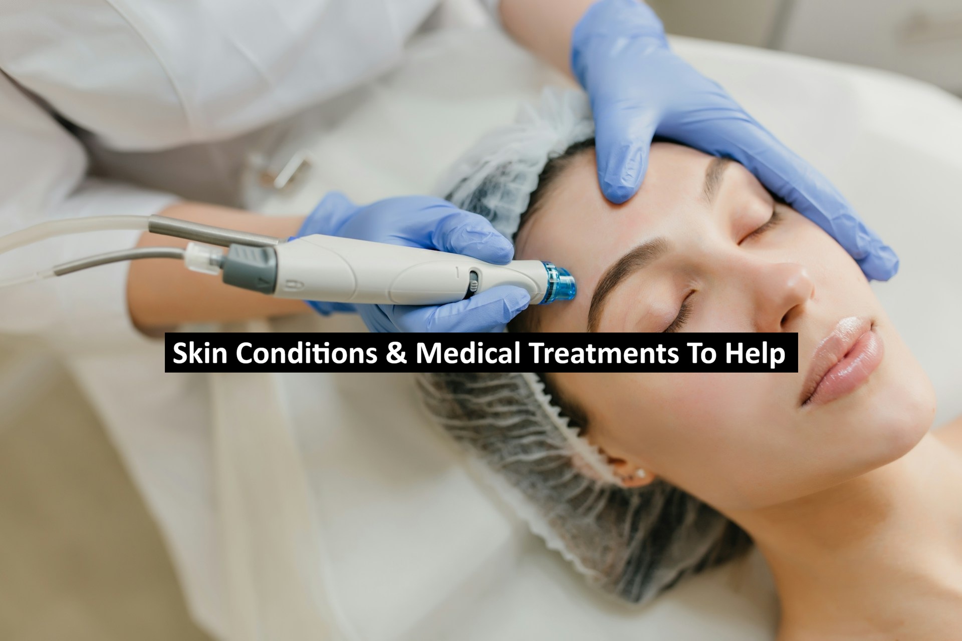 Skin Conditions & Medical Treatments To Help
